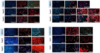 Scorpion Venom Antimicrobial Peptides Induce Caspase-1 Dependant Pyroptotic Cell Death